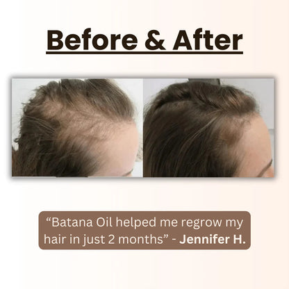 EcoOily™ - Natural Herbal Handcrafted Batana Oil Hair