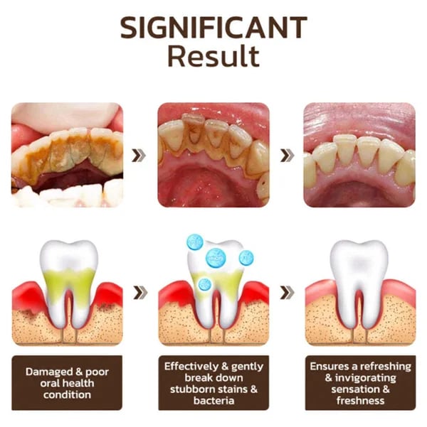 Nicyo™ - Nicotinamide Whitening Toothpaste