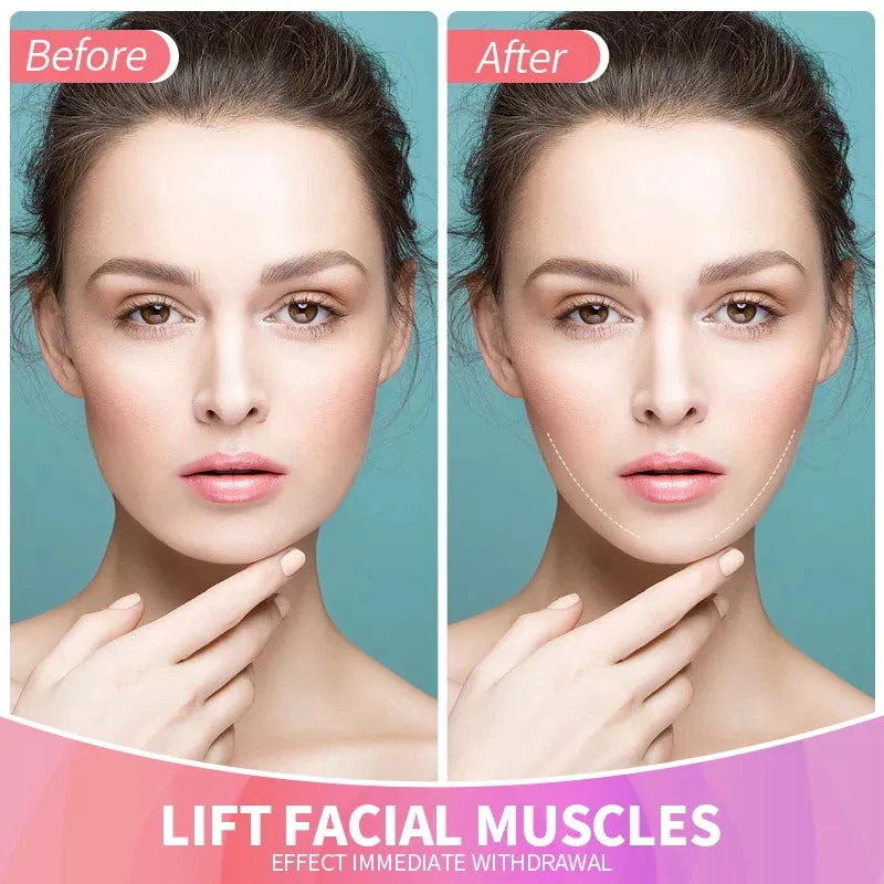 BioLift™ - Invisible Face Lift Stickers